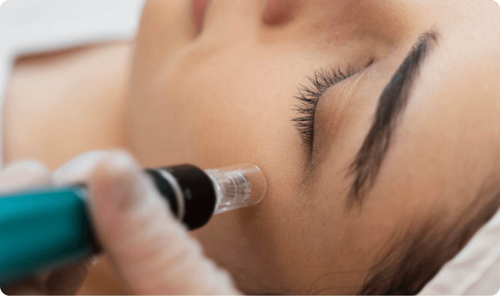 Placeholder Image (62) (1)